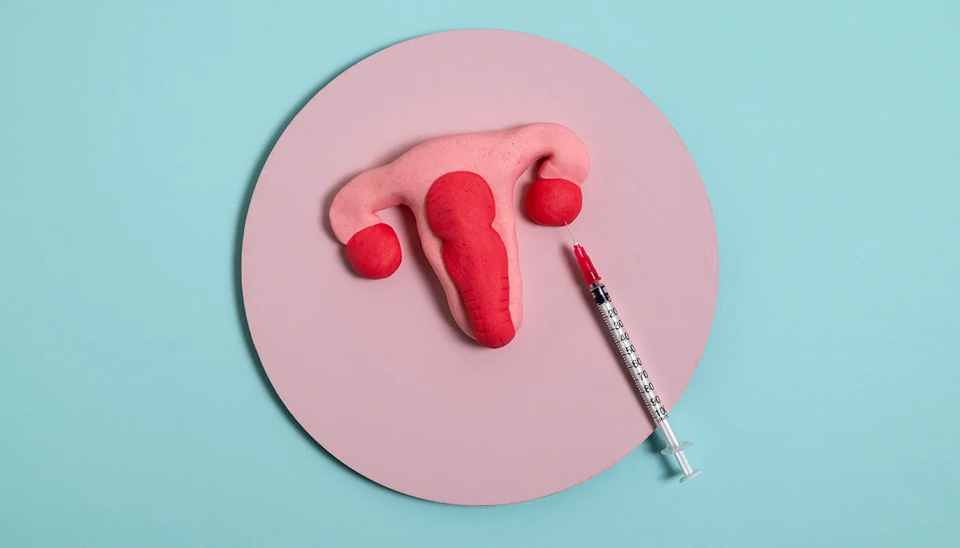 Yumurtalıklara (Overlere) Eksozom Uygulaması Nedir?