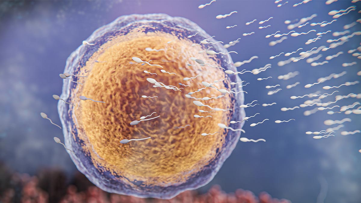 İlk tüp bebek denemesi sonrası değerlendirilen yumurta ve sperm faktörlerini gösteren tıbbi görsel