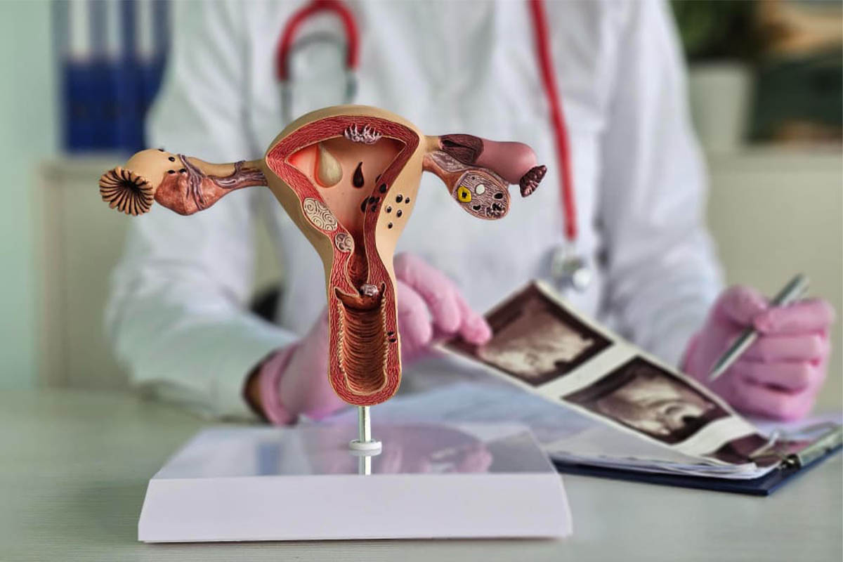 Adenomyozis ve embriyo tutunmasını rahim modeli üzerinden değerlendiren doktor