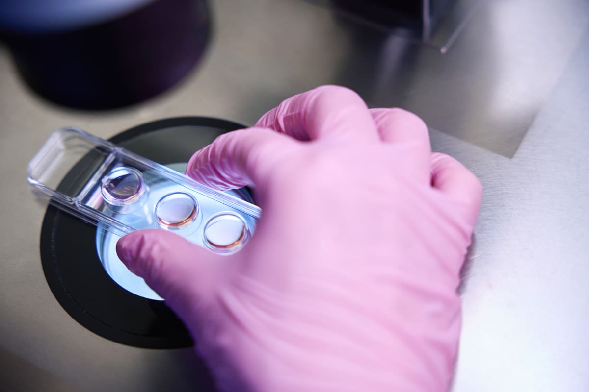 dondurulmuş embriyo işlemlerinde laboratuvar süreçlerinden bir kesit