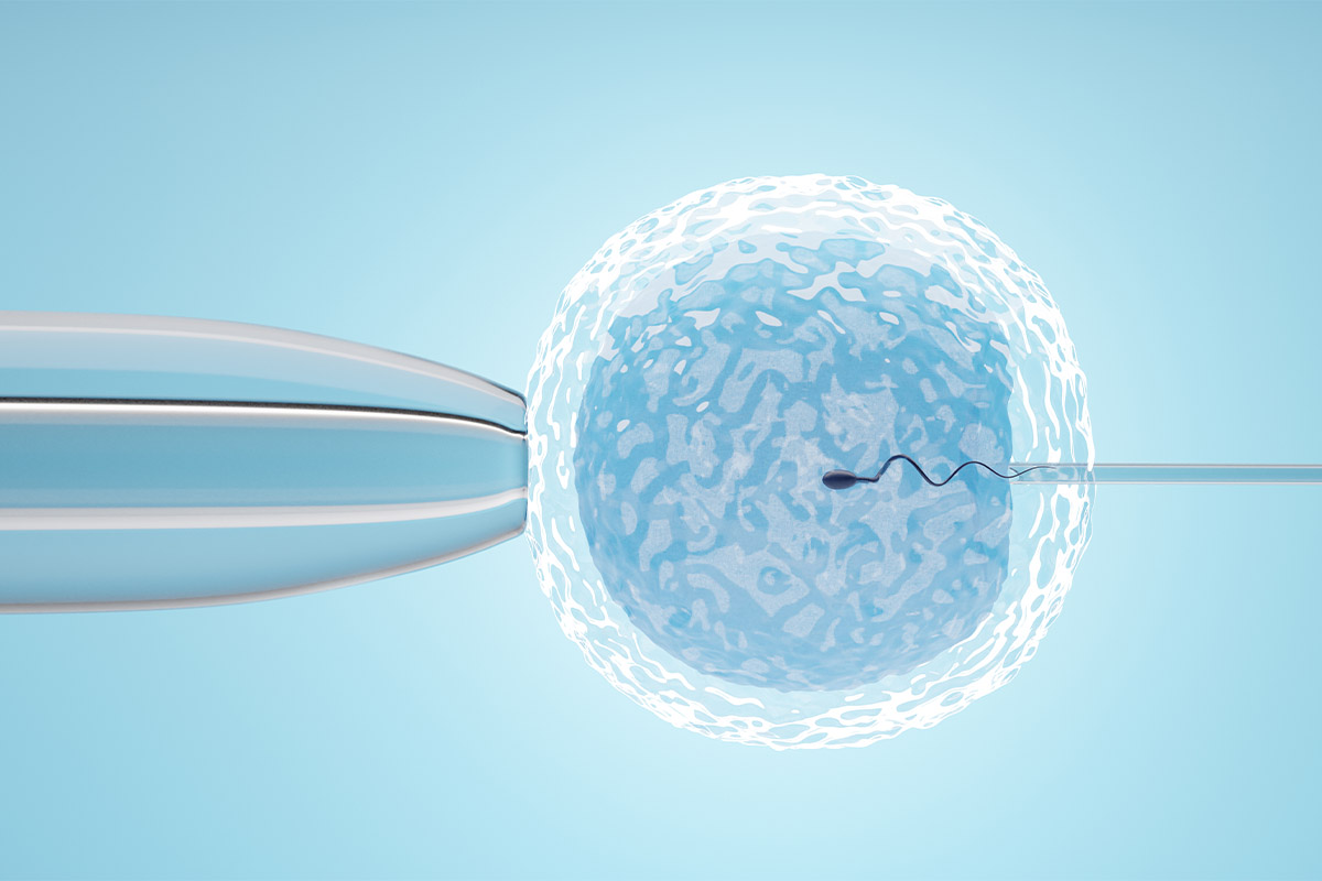 Açık mavi bir arka planda, mikroenjeksiyon yöntemini simgeleyen; bir sperm hücresinin yumurtaya giriş anını gösteren dijital illüstrasyon.