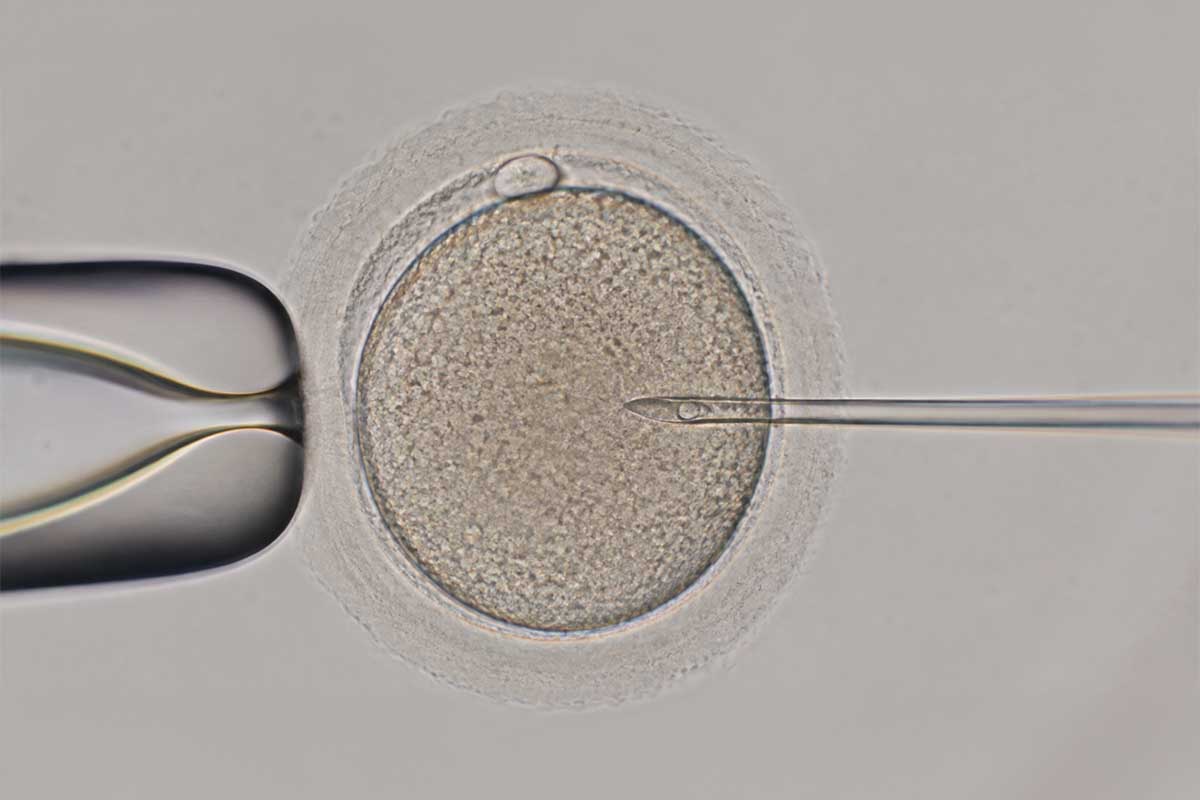 Mikroenjeksiyon sırasında sperm enjekte edilen yumurta hücresi